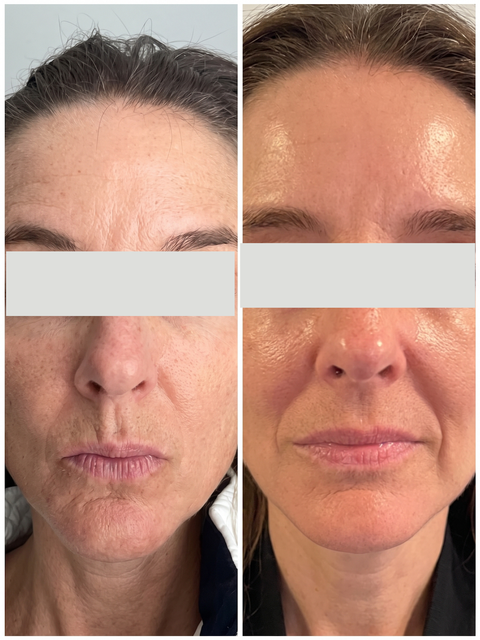 Customer before and after result